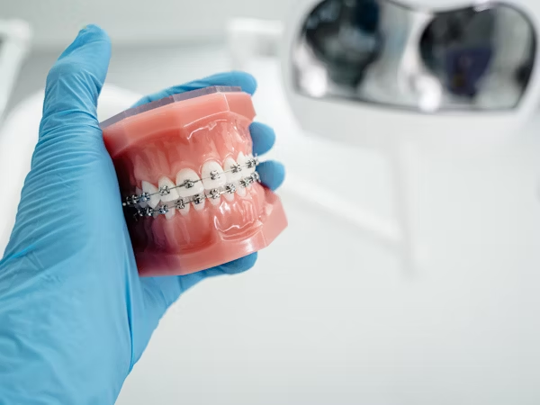 hand with gloves holding a dental model with braces