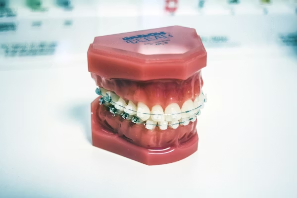 photo showing a dental model with retainers