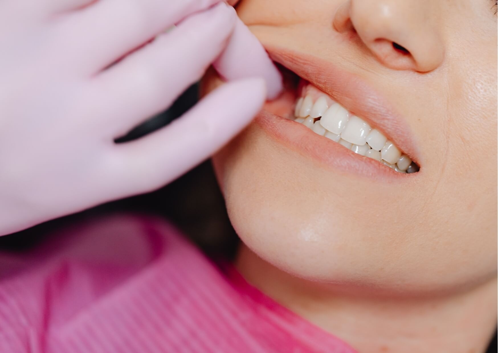 Close-up of a patient’s smile during a braces evaluation to assess tooth alignment and orthodontic treatment needs