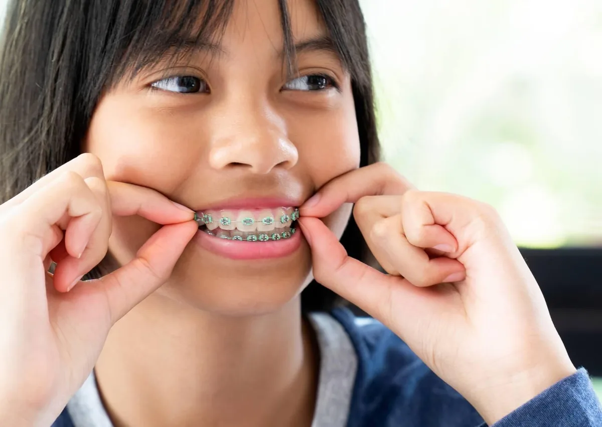 Child wearing braces and adjusting orthodontic elastics during treatment.