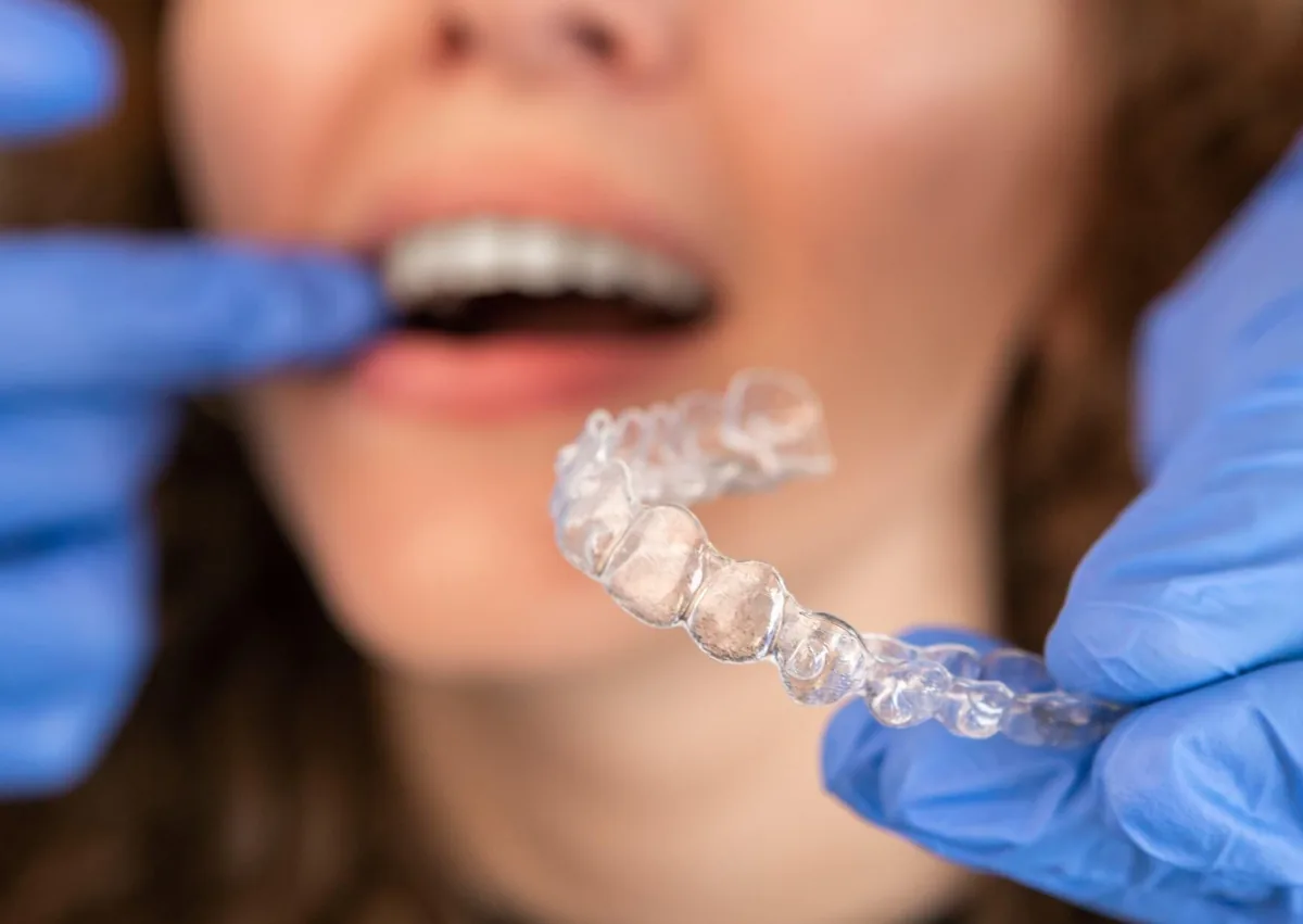 Clear retainer used to help prevent teeth shifting after braces.
